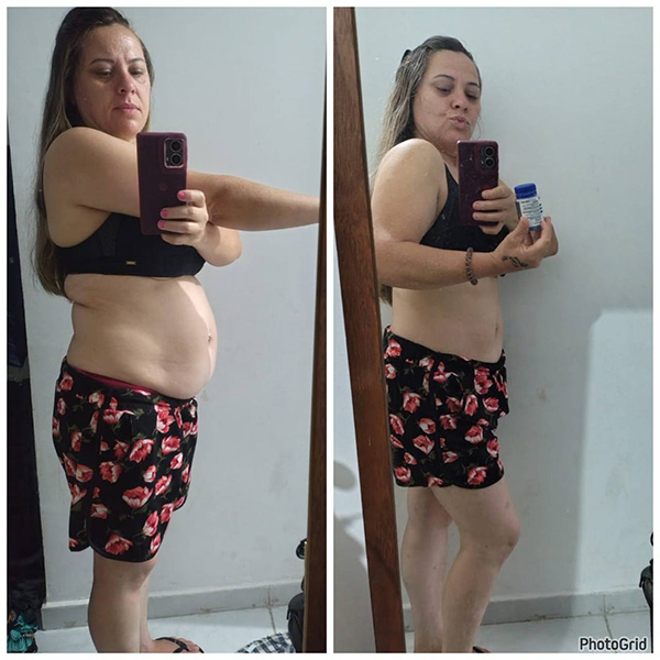 Resultados de outra pessoa com o Ozenvitta